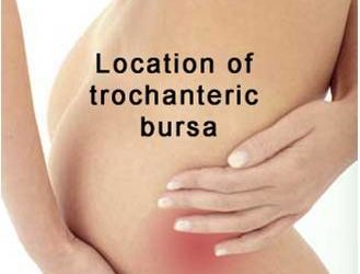 Tratamiento para Bursitis Trocantérea